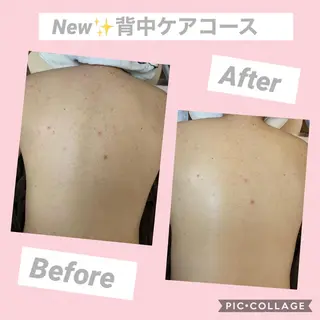 COCOPURE. 凪..のエステ・リラクイメージ