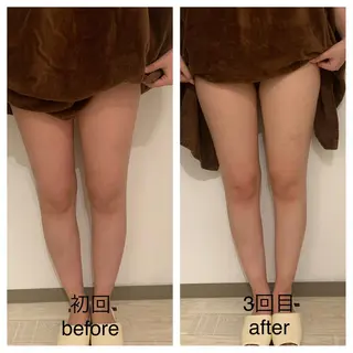 リンパマッサージ mimozaのエステ・リラクイメージ