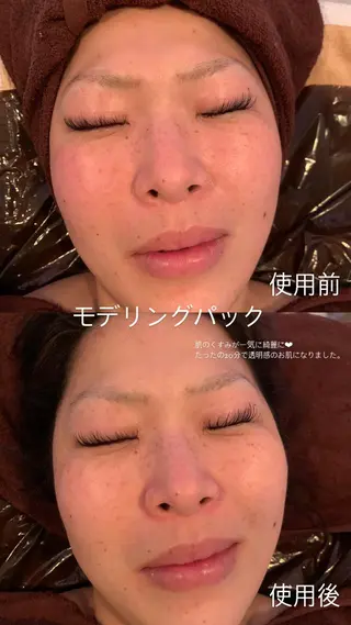 ワックス脱毛 ♡AYO♡のエステ・リラクイメージ