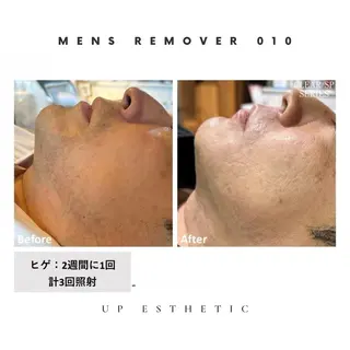 メンズ 韓国肌管理 ウプエステティックのエステ・リラクイメージ