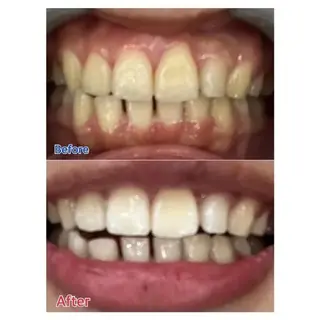 M渋谷 ホワイトニングのエステ・リラクイメージ