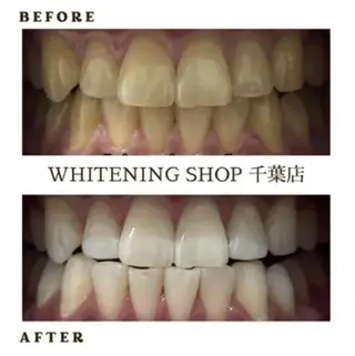 メンズ ホワイトニング ショップ千葉店のその他イメージ