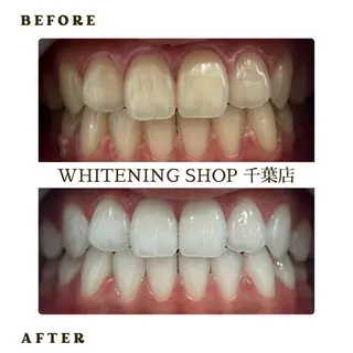 メンズ ホワイトニング ショップ千葉店のその他イメージ