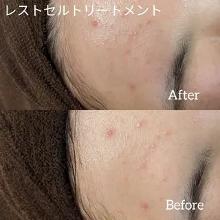 ﾌｪｲｼｬﾙｴｽﾃ ﾗﾄｩｰﾙ伊深のエステ・リラクイメージ