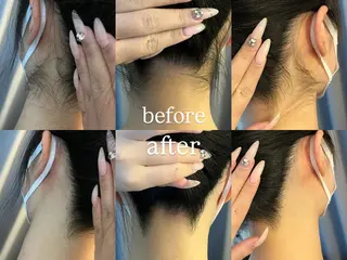 うなじ脱毛/美肌脱毛 LABELのエステ・リラクイメージ