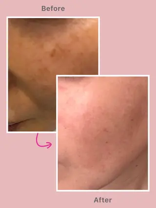 ELEGANCE所属・メンズ脱毛サロン BRIGHTのエステ・リラクイメージ