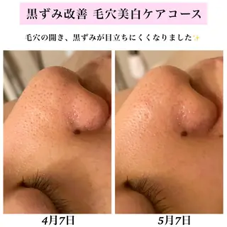 Bellesthe (ベルエステ)のエステ・リラクイメージ