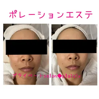 De I'm 可児店のエステ・リラクイメージ