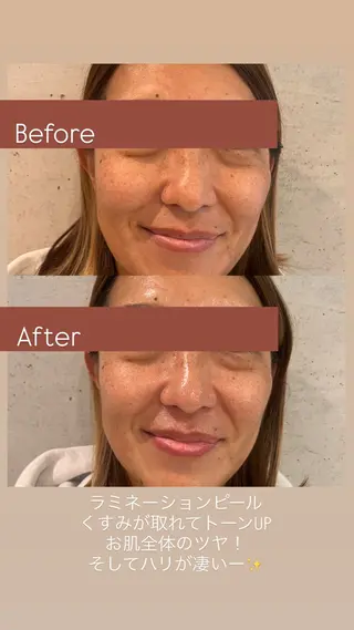 Joo🌿ナツキ 肌育/エイジングのその他イメージ