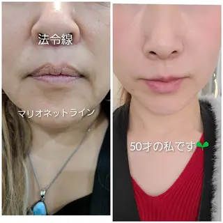 【トータル美容】 Eternityのその他イメージ