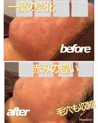 ミディアム カラー パーマ ヘアアレンジ メンズ キッズ ネイル 金の糸脱毛 産毛ケア専門のエステ・リラクイメージ