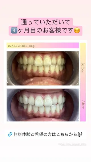 セルフホワイトニング エクシア秋田大町店のその他イメージ