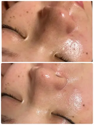 beauty  salon sorelle所属・産毛角質ケア/艶肌 フェイシャルワックスのエステ・リラクイメージ