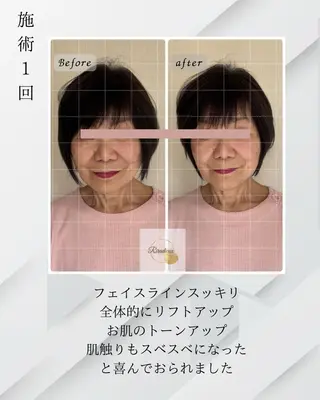 Riradieux ﾘﾗﾃﾞｭ所属・Riradieux 美骨小顔矯正のその他イメージ