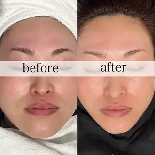 FOXYLASH inoueのエステ・リラクイメージ