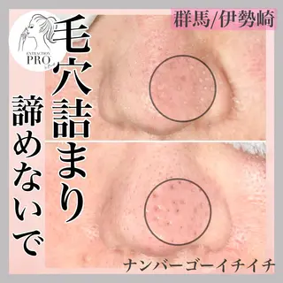 脱毛&フェイシャル NO.511のエステ・リラクイメージ