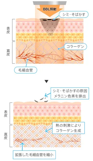 メンズ 脱毛サロン BRIDGE橋本のエステ・リラクイメージ