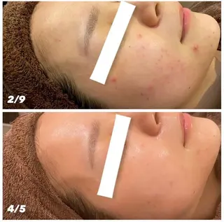 本気の肌質改善スキン デトックス🌿のエステ・リラクイメージ