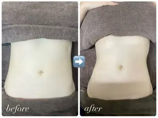 ayaka🤍インデ ィバ🇰🇷のエステ・リラクイメージ