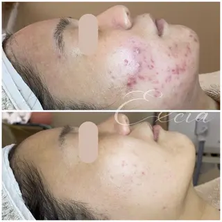 EXCIA所属・EXCIA （エクシア）のエステ・リラクイメージ