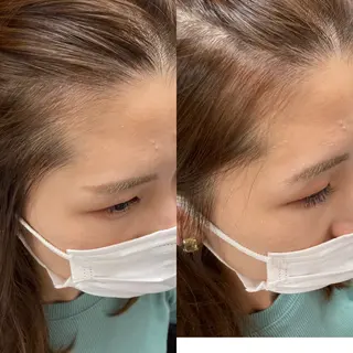 パーマ 松下 輝璃のヘアスタイル