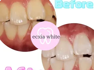 セルフホワイトニング エクシア浜松店のその他イメージ