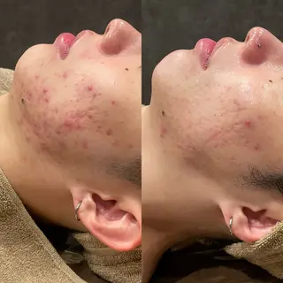 Re:Belle 久留米 : 中島のエステ・リラクイメージ