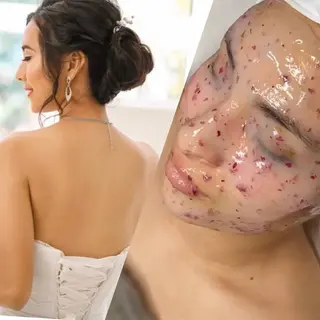 Ladies’ ShavingAmoのエステ・リラクイメージ