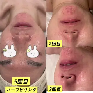 痩身・小顔・脱毛・ オイル&Amourのその他イメージ