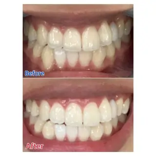 MBEAUTYSALON 千葉店・京成大久保所属・Melty 輝のその他イメージ