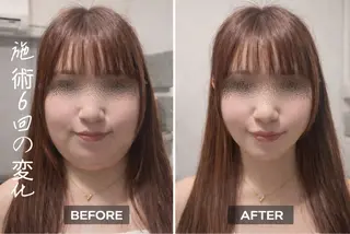 【歴13年】劇的小顔 D rマジックタッチのエステ・リラクイメージ