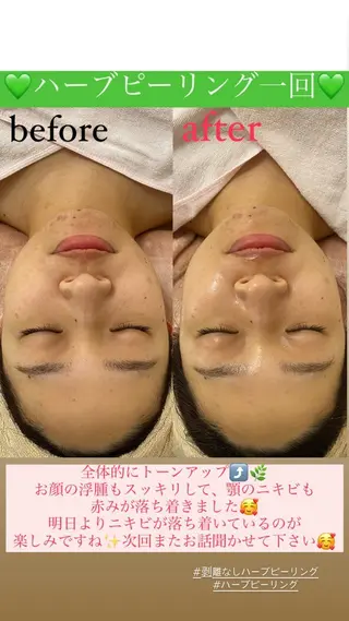 メンズ Salon de Lino 御器所のエステ・リラクイメージ