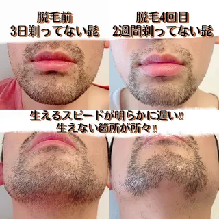 メンズ HBL/立川/眉毛 上野由理の眉毛・アイブロウイメージ
