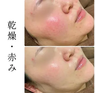 ハーブピーリング専門 BIOPLUS＋川崎のエステ・リラクイメージ