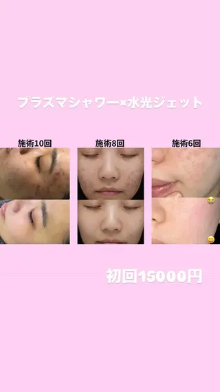 ミディアム 愛維美水光美肌専門店 メンズレディースokのエステ・リラクイメージ