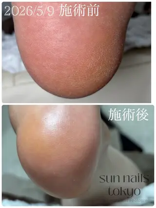 ネイル Sun Nails Tokyo大網白里市のネイルデザイン