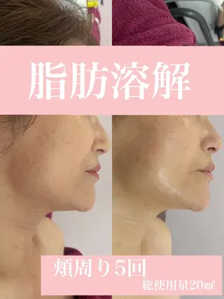 Total Beauty Rita.所属・トータルビューティ Rita.のエステ・リラクイメージ