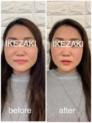 美容鍼 IKEZAKIのエステ・リラクイメージ