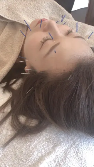 美容鍼・鍼灸専門❤✨ 近藤めぐみのエステ・リラクイメージ