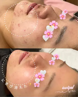 肌質改善サロン ココマヒナのエステ・リラクイメージ