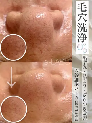 e-LABO こいずみのエステ・リラクイメージ