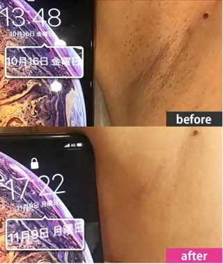 EfiNエフィン 青山店 小池のエステ・リラクイメージ