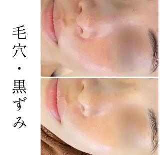 ハーブピーリング専門 BIOPLUS+川崎のエステ・リラクイメージ
