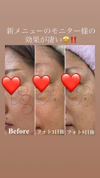 Clover所属・Clover marikoの眉毛・アイブロウイメージ