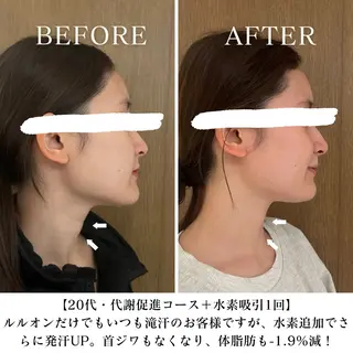 【目黒】本格痩身✴︎ 最新型よもぎ蒸しのエステ・リラクイメージ