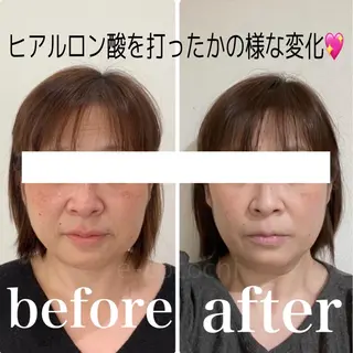 小顔と ヘッドスパのお店のエステ・リラクイメージ