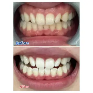 M渋谷 ホワイトニングのエステ・リラクイメージ