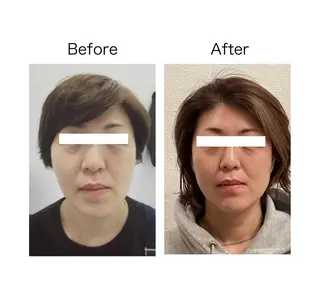 小顔サロン sharpのエステ・リラクイメージ