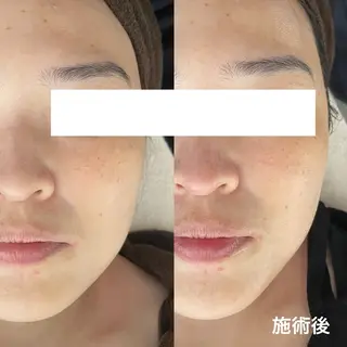 サロンドフルベール 折尾店のエステ・リラクイメージ