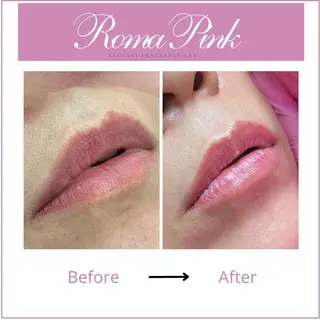 メンズ キッズ ホワイトニングサロン プレジールのエステ・リラクイメージ